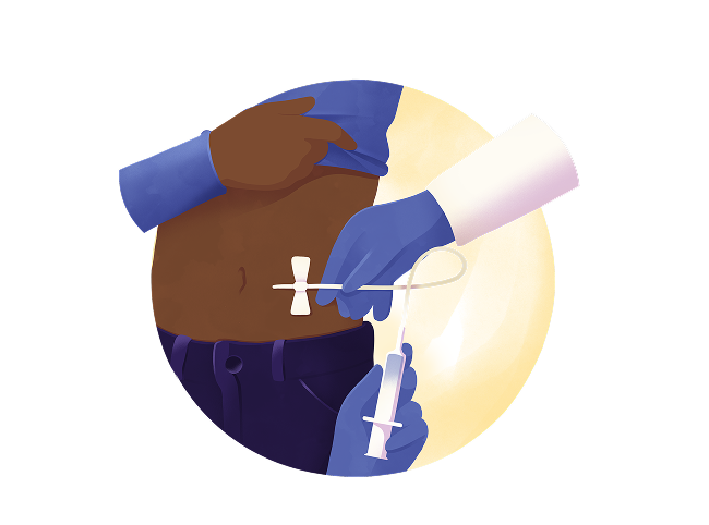 OCREVUS® (ocrelizumab) | MS Treatment Experience